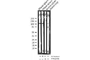 Western blot analysis of Phospho-NF kappaB p105/p50 (Ser927) expression in various lysates (NFKB1 Antikörper  (pSer927))