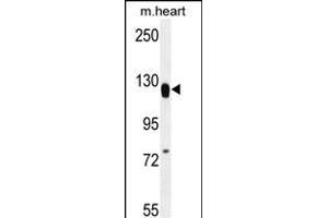 MED14 Antibody (Center) (ABIN656136 and ABIN2845475) western blot analysis in mouse heart tissue lysates (35 μg/lane). (MED14 Antikörper  (AA 586-615))