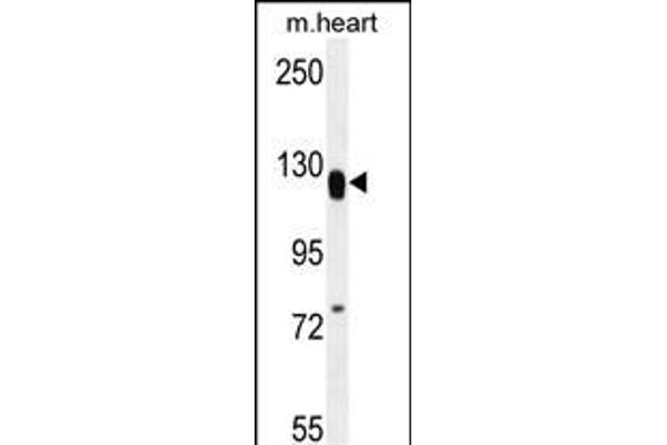 MED14 Antikörper  (AA 586-615)