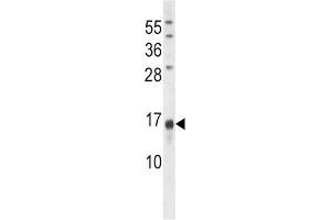 Western Blotting (WB) image for anti-Osteocalcin (BGLAP) antibody (ABIN3001265) (Osteocalcin Antikörper)