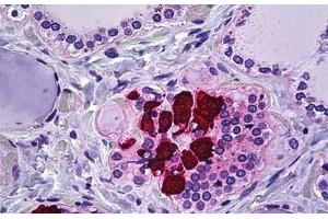 Human Thyroid, C-cells: Formalin-Fixed, Paraffin-Embedded (FFPE) (CIB2 Antikörper  (AA 21-70))