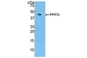 Detection of Recombinant C3, Human using Polyclonal Antibody to Complement Component 3 (C3) (C3 Antikörper  (AA 1000-1326))