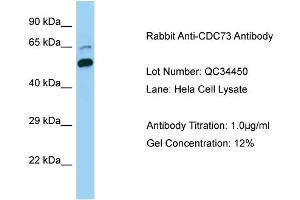 Host: Rabbit Target Name: CDC73 Sample Type: Human Hela Cell Antibody Dilution: 1. (HRPT2 Antikörper  (C-Term))