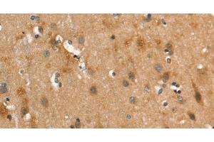 Immunohistochemistry of paraffin-embedded Human brain using CALCRL Polyclonal Antibody at dilution of 1:40 (CALCRL Antikörper)