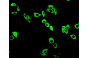 Detection of GCLM in MCF7 cells using Polyclonal Antibody to Glutamate Cysteine Ligase, Modifier Subunit (GCLM) (GCLM Antikörper  (AA 40-251))