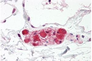 Image no. 2 for anti-Discs, Large Homolog 4 (Drosophila) (DLG4) (AA 683-732) antibody (ABIN6749749) (DLG4 Antikörper  (AA 683-732))