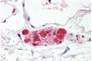 Image no. 2 for anti-Discs, Large Homolog 4 (Drosophila) (DLG4) (AA 683-732) antibody (ABIN6749749)