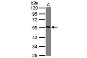 Image no. 1 for anti-Glycosyltransferase-Like Domain Containing 1 (GTDC1) (AA 1-164) antibody (ABIN1498562) (GTDC1 Antikörper  (AA 1-164))