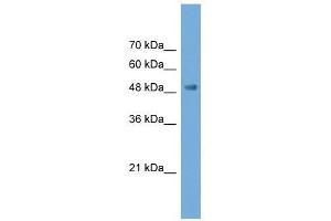 Western Blot showing NPTX2 antibody used at a concentration of 1-2 ug/ml to detect its target protein. (NPTX2 Antikörper  (N-Term))