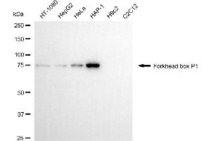 Western blotting analysis using forkhead box P1 antibody (ABIN7798651).