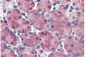 Stomach: Formalin-Fixed, Paraffin-Embedded (FFPE) (ERP44 Antikörper  (Internal Region))