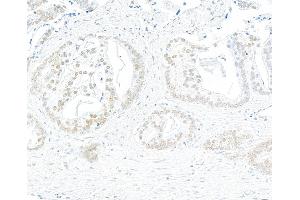 Immunohistochemistry (IHC) image for anti-Bromodomain Containing 7 (BRD7) (AA 601-651) antibody (ABIN7453996)