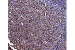 IHC analysis of CD40/TNFRSF5 using anti-CD40/TNFRSF5 antibody (ABIN4886525). (CD40 Antikörper  (AA 21-193))