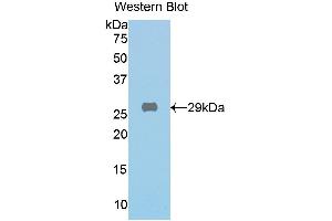 Detection of recombinant GLb using Polyclonal Antibody to Galactosidase Beta (GLb)