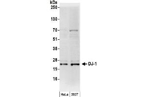 Western Blotting (WB) image for anti-Parkinson Protein 7 (PARK7) (C-Term) antibody (ABIN7454672)