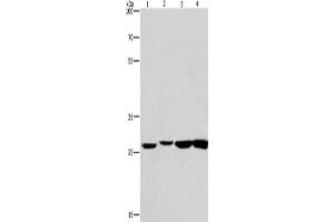 Gel: 8 % SDS-PAGE, Lysate: 40 μg, Lane 1-4: Humna colon cancer tissue, mouse kidney tissue, mouse testis tissue, human fetal brain tissue, Primary antibody: ABIN7130004(KLF7 Antibody) at dilution 1/483.