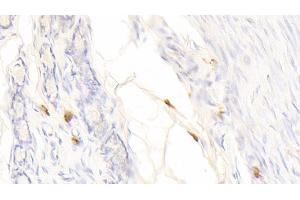 Immunohistochemistry (IHC) image for anti-Tryptase alpha/beta 1 (TPSAB1) (AA 151-275) antibody (ABIN7433102)