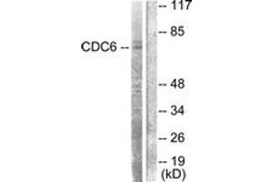 Western Blotting (WB) image for anti-Cell Division Cycle 6 Homolog (S. Cerevisiae) (CDC6) (AA 20-69) antibody (ABIN2888619) (CDC6 Antikörper  (AA 20-69))
