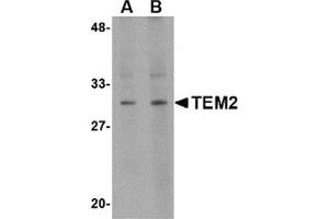 Western blot analysis of TEM2 in human colon tissue lysate with this product at (A) 1 and (B) 2 μg/ml. (RASD2 Antikörper  (C-Term))