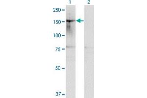 Western Blot analysis of HDAC6 expression in transfected 293T cell line by HDAC6 monoclonal antibody (M01), clone 1E2.