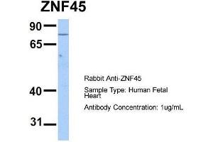 Host:  Rabbit  Target Name:  ZNF45  Sample Type:  Human Fetal Heart  Antibody Dilution:  1. (ZNF45 Antikörper  (N-Term))