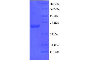 SDS-PAGE (SDS) image for delta-Like 2 Homolog (DLK2) (AA 27-306), (Extracellular) protein (His tag) (ABIN4974245) (DLK2 Protein (AA 27-306, Extracellular) (His tag))