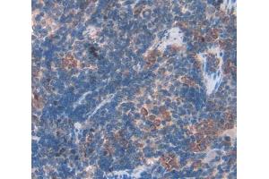 Used in DAB staining on fromalin fixed paraffin- embedded Kidney tissue (BAFF Antikörper  (AA 21-169))