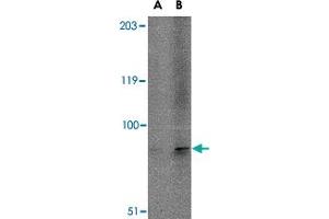 Western blot analysis of TMC6 in A-20 cell lysate with TMC6 polyclonal antibody  at (A) 1 and (B) 2 ug/mL . (TMC6 Antikörper  (N-Term))