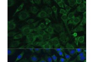 Immunofluorescence analysis of C6 cells using OSM Polyclonal Antibody at dilution of 1:100. (Oncostatin M Antikörper)