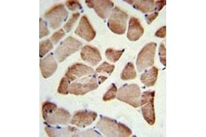 Immunohistochemistry analysis in formalin fixed and paraffin embedded skeletal muscle reacted with LFNG Antibody (Center) followed by peroxidase conjugation of the secondary antibody and DAB staining. (LFNG Antikörper  (Middle Region))