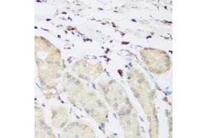 Immunohistochemistry of paraffin-embedded human stomach using PLEK antibody (ABIN6290796) at dilution of 1:200 (40x lens). (Pleckstrin Antikörper)