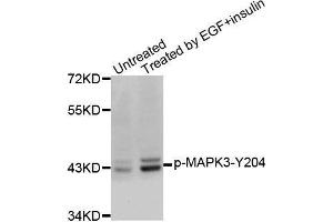 Western blot analysis of extracts from SK-BR-3 cells, using Phospho-MAPK3-Y204 antibody. (ERK1 Antikörper  (pTyr204))