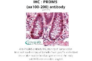 Image no. 1 for anti-PR Domain Containing 5 (PRDM5) (AA 100-200) antibody (ABIN1738318) (PRDM5 Antikörper  (AA 100-200))