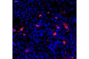 Immunofluorescence (Paraffin-embedded Sections) (IF (p)) image for anti-Caspase 3 (CASP3) (cleaved) antibody (ABIN7073336)