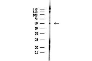 anti-Perilipin 1 (PLIN1) (C-Term) antibody