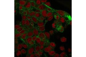 Immunofluorescence staining of PFA-fixed HepG2 cells with Catenin, gamma Mouse Monoclonal Antibody (rCTNG/1664) followed by goat anti-Mouse IgG-CF488 (Green). (Rekombinanter JUP Antikörper)