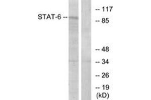 Western blot analysis of extracts from HeLa cells, using STAT6 (Ab-641) Antibody. (STAT6 Antikörper  (AA 608-657))