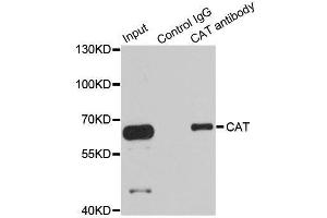 Immunoprecipitation analysis of 100ug extracts of HepG2 cells using 3ug CAT antibody.