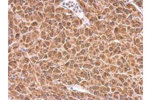 IHC-P Image PRKCSH antibody detects PRKCSH protein at cytosol on U87 xenograft by immunohistochemical analysis. (PRKCSH Antikörper)