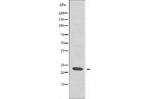 Western blot analysis of extracts from JurKat cells using RPS7 antibody. (RPS7 Antikörper  (C-Term))