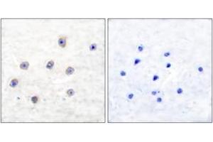 Immunohistochemistry analysis of paraffin-embedded human brain, using Tyrosine Hydroxylase (Phospho-Ser31) Antibody. (Tyrosine Hydroxylase Antikörper  (pSer62))