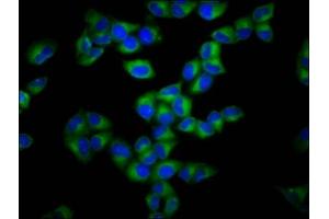 Immunofluorescence staining of Hela cells with ABIN7153647 at 1:133, counter-stained with DAPI. (Gasdermin A Antikörper  (AA 64-172))