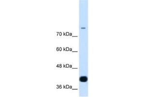 Western Blotting (WB) image for anti-MDS1 and EVI1 Complex Locus (MECOM) antibody (ABIN2460268) (MECOM Antikörper)