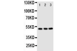Anti-CXCR4 antibody, Western blotting Lane 1: M231 Cell Lysate Lane 2: MCF-7 Cell Lysate Lane 3: JURKAT Cell Lysate