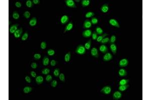 Immunofluorescence (IF) image for anti-Histone Cluster 1, H3a (HIST1H3A) (pSer28) antibody (ABIN7139619)