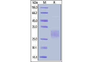 SDS-PAGE (SDS) image for CD47 (CD47) (AA 19-140) (Active) protein (His tag) (ABIN6809863)