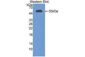 Detection of Recombinant CFI, Human using Polyclonal Antibody to Complement Factor I (CFI) (Complement Factor I Antikörper  (AA 28-243))