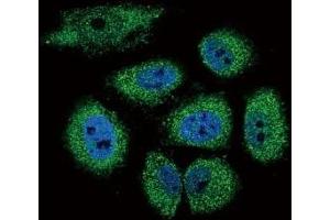 Confocal immunofluorescent analysis of DROSHA antibody with NCI-H460 cells followed by Alexa Fluor 488-conjugated goat anti-rabbit lgG (green).