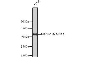 Western blot analysis of extracts of 22Rv1 cells, using MAGE-1/MA antibody (ABIN6132325, ABIN6143435, ABIN6143436 and ABIN6221133) at 1:1000 dilution. (MAGEA1 Antikörper  (AA 1-309))
