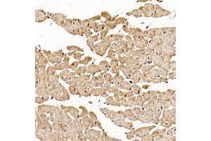 Immunohistochemistry of paraffin-embedded rat heart using RC Rabbit pAb (ABIN6129452, ABIN6146811, ABIN6146812 and ABIN6220955) at dilution of 1:150 (40x lens). (RCAN1 Antikörper  (AA 60-245))